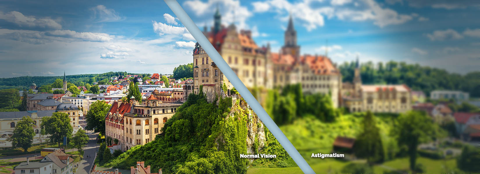 Astigmatism Treatment in Glendale